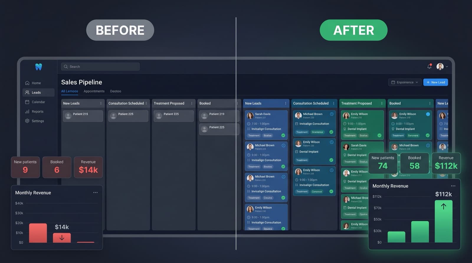 Dental CRM leads pipeline before and after SaaSi